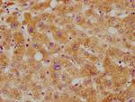 CETP Antibody in Immunohistochemistry (Paraffin) (IHC (P))