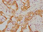 RARA Recombinant Rabbit Monoclonal Antibody (4A10)