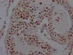 LSD1 Recombinant Rabbit Monoclonal Antibody (1G7)