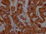 CD8a Antibody in Immunohistochemistry (Paraffin) (IHC (P))