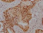 PRMT5 Recombinant Rabbit Monoclonal Antibody (2H4)