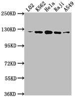 ATP Citrate Lyase Antibody in Western Blot (WB)
