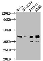 ISL1 Recombinant Rabbit Monoclonal Antibody (4F6)