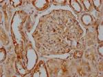 CD51 Antibody in Immunohistochemistry (Paraffin) (IHC (P))