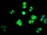 PKM2 Recombinant Rabbit Monoclonal Antibody (7B2)