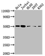 Caspase 2 Recombinant Rabbit Monoclonal Antibody (7E5)