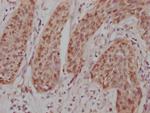 c-Jun Recombinant Rabbit Monoclonal Antibody (10D4)