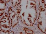 FOXA1 Recombinant Rabbit Monoclonal Antibody (3B2)