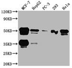 FOXA1 Antibody in Western Blot (WB)