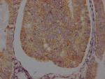 beta-2 Adrenergic Receptor Recombinant Rabbit Monoclonal Antibody (4C11)