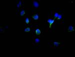 Tyrosinase Recombinant Rabbit Monoclonal Antibody (6B2)