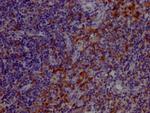 TLR7 Recombinant Rabbit Monoclonal Antibody (6E5)