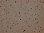 PARP1 Antibody in Immunohistochemistry (Paraffin) (IHC (P))