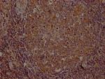 ITK Recombinant Rabbit Monoclonal Antibody (8F10)