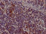 JAK3 Recombinant Rabbit Monoclonal Antibody (1C7)