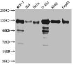 KIF11 Recombinant Rabbit Monoclonal Antibody (1G11)