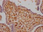 LOXL2 Antibody in Immunohistochemistry (Paraffin) (IHC (P))