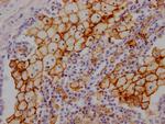 ACE Antibody in Immunohistochemistry (Paraffin) (IHC (P))
