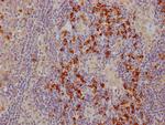 CTLA-4 Recombinant Rabbit Monoclonal Antibody (3B10)