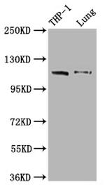 MDA5 Recombinant Rabbit Monoclonal Antibody (3D12)