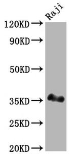 BOB-1 Antibody in Western Blot (WB)