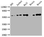 PAK2 Recombinant Rabbit Monoclonal Antibody (6D12)