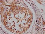 B-Raf Antibody in Immunohistochemistry (Paraffin) (IHC (P))