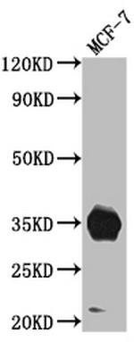 IGFBP2 Antibody in Western Blot (WB)