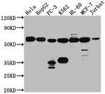 PTBP1 Antibody in Western Blot (WB)