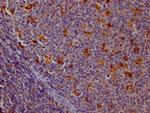 Cathepsin S Recombinant Rabbit Monoclonal Antibody (9B10)
