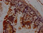 Chk1 Antibody in Immunohistochemistry (Paraffin) (IHC (P))