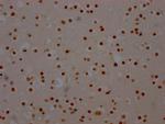 SF3B1 Antibody in Immunohistochemistry (Paraffin) (IHC (P))