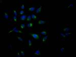 Amyloid Precursor Protein Recombinant Rabbit Monoclonal Antibody (6F10)