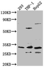 COMT Antibody in Western Blot (WB)