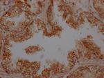 Urokinase Recombinant Rabbit Monoclonal Antibody (10E5)