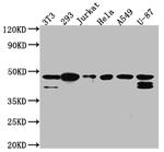CK2 alpha-1 Recombinant Rabbit Monoclonal Antibody (2B6)