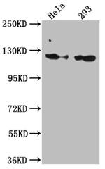 RNF20 Antibody in Western Blot (WB)