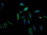 AKR1C3 Antibody in Immunocytochemistry (ICC/IF)
