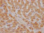 ABAT Recombinant Rabbit Monoclonal Antibody (5B6)