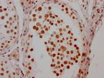 HSF1 Antibody in Immunohistochemistry (Paraffin) (IHC (P))