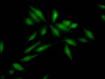SKP2 Recombinant Rabbit Monoclonal Antibody (6D4)