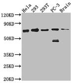 LTA4H Recombinant Rabbit Monoclonal Antibody (6G7)