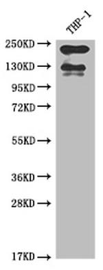CD11a Antibody in Western Blot (WB)