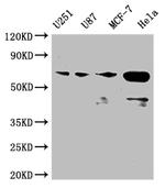 MST2 Antibody in Western Blot (WB)