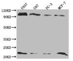 LMO2 Recombinant Rabbit Monoclonal Antibody (9H9)