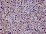 PKN2 Antibody in Immunohistochemistry (Paraffin) (IHC (P))