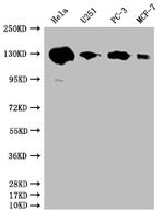 PKN2 Antibody in Western Blot (WB)