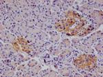 CD166 Recombinant Rabbit Monoclonal Antibody (21B9)
