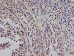 STAT4 Antibody in Immunohistochemistry (Paraffin) (IHC (P))