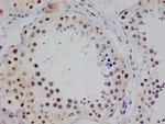 STAT4 Antibody in Immunohistochemistry (Paraffin) (IHC (P))